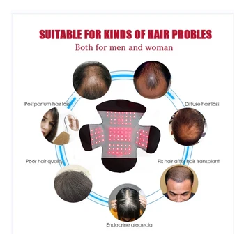 Усовершенствованный светодиодный шлем для восстановления волос лечение 100 медицинскими диодами колпачок для быстрого роста решение для выпадения волос